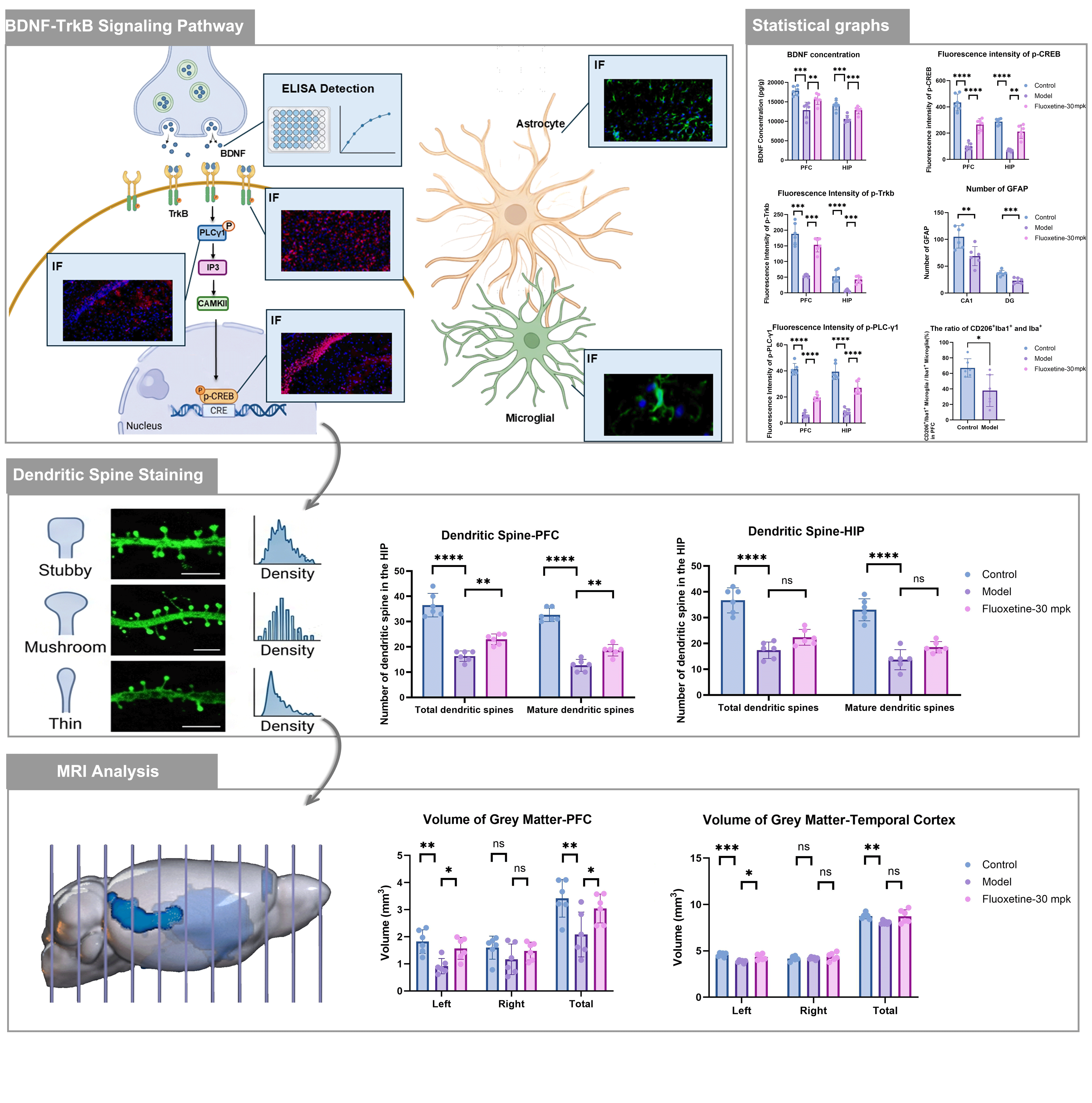 BDNF-TrkB pathway, molecular mechanisms, cellular plasticity, and brain structural changes in the CUMS model