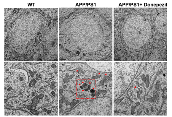 TEM mitochondrial ultrastructure in APP/PS1 model