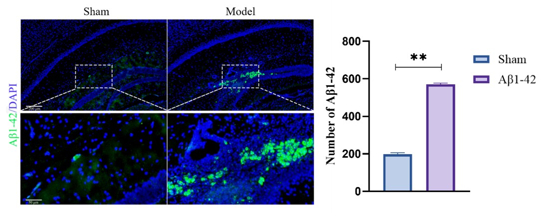 Amyloid pathology in Aβ1-42 model