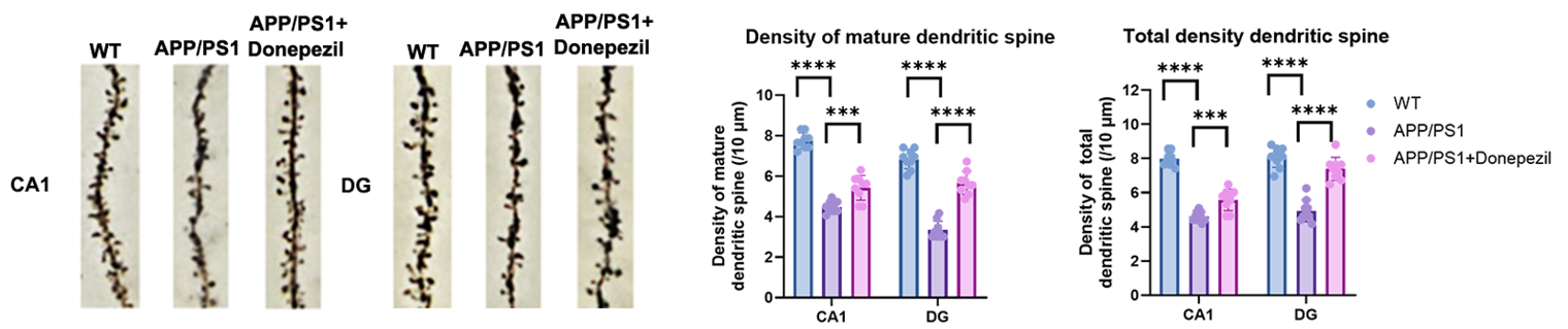 Golgi staining of dendritic spines in APP/PS1 model