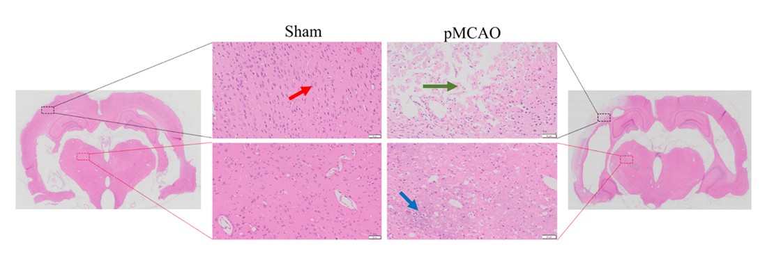 HE staining of ischemic brain injury in pMCAO rat model