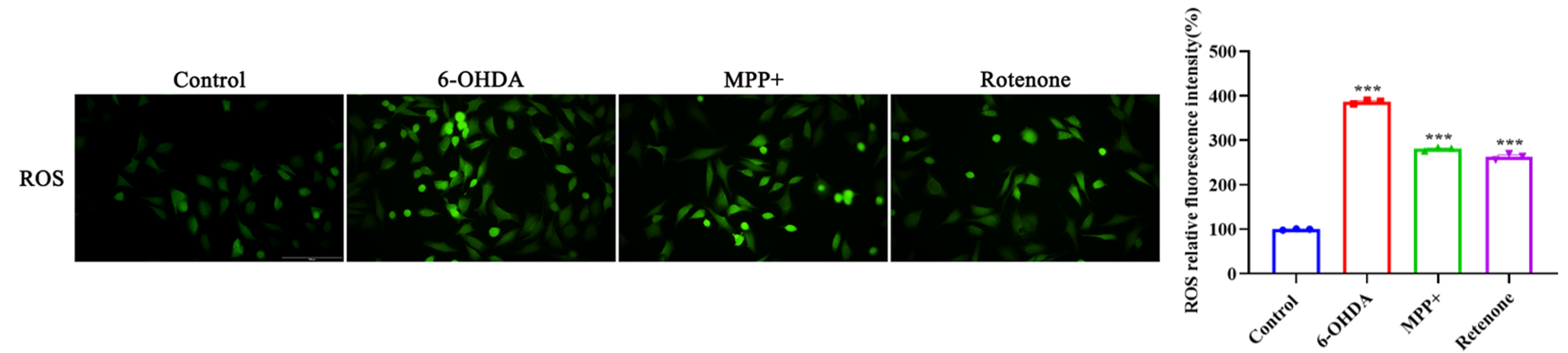 Intracellular ROS detection in SH-SY5Y cells