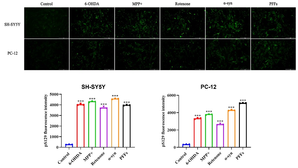 pSer129-α-synuclein immunofluorescence in SH-SY5Y and PC-12 cells