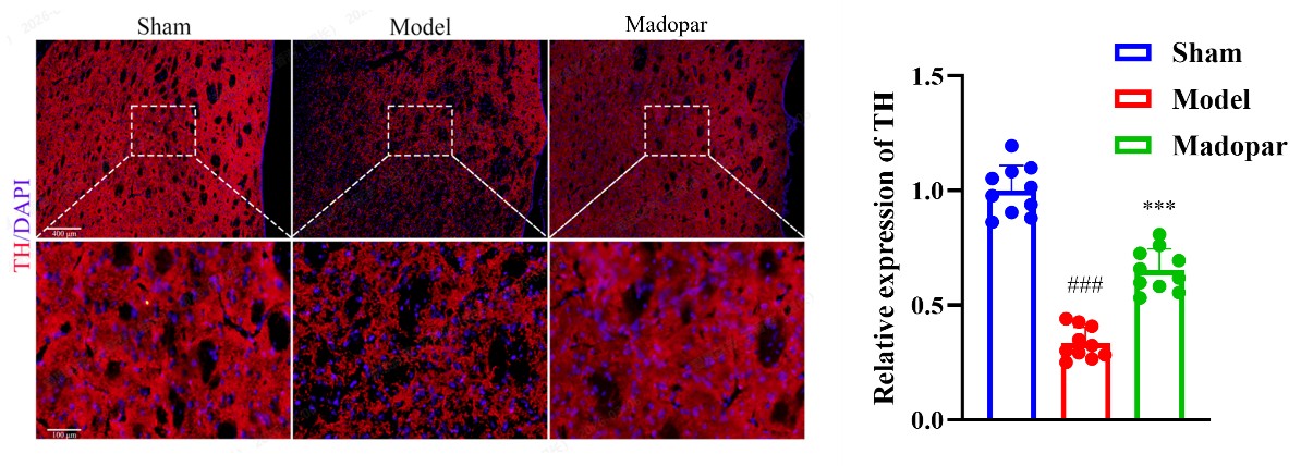 TH IF in the Striatum