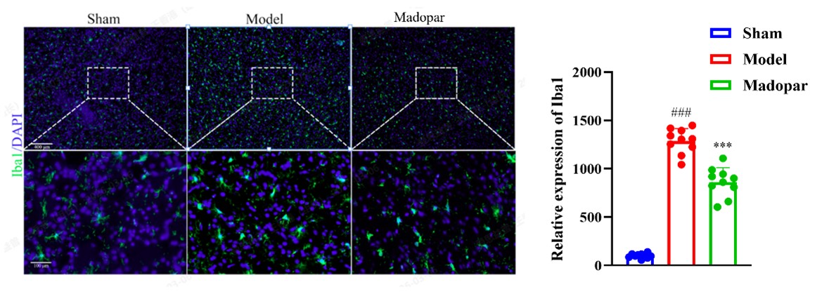 Iba1 IF in the Striatum